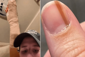 عانت من خط تحت ظفرها لـ10 سنوات.. ثم اكتشفت حقيقة مدمرة