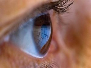 علامات في عينيك قد تدل على الإصابة بمرض السكري