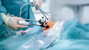 جراحة تكميم المعدة متى ينصح الطب بإجراء جراحة السمنة؟ وما فوائدها ومخاطرها؟