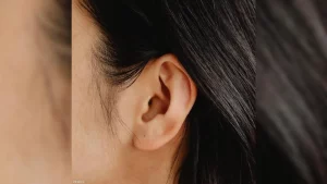 شمع الأذن قد يكون مؤشرا على هذه الأمراض