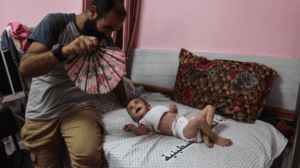 انتشار امراض جلدية خطرة بين الاطفال في قطاع غزة