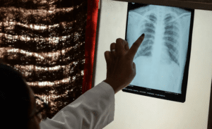 هذا مقدار ما تلتهمه سيجارة واحدة من عمرك